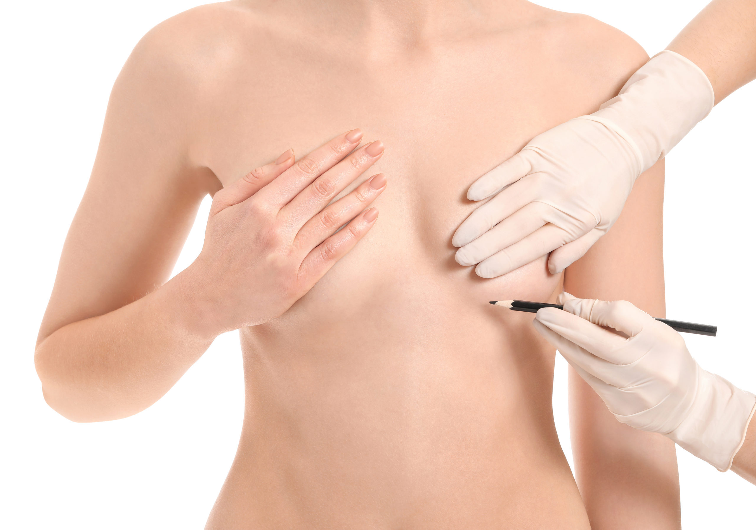 Doctor applying marking on woman's chest against white background. Concept of breast augmentation